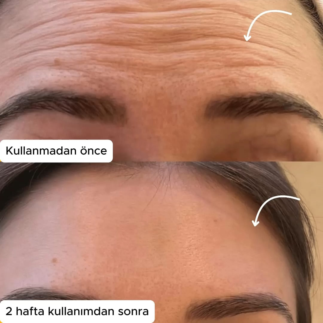 LenfMasaj Kontür Yüz Fırçası - Lenf Drenajı Masaj Fırçası (Kısa Süreliğine 1 Alana 1 Bedava!)