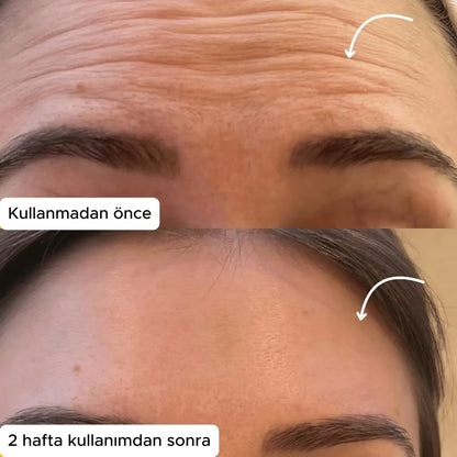 LenfMasaj Kontür Yüz Fırçası - Lenf Drenajı Masaj Fırçası (Kısa Süreliğine 1 Alana 1 Bedava!)