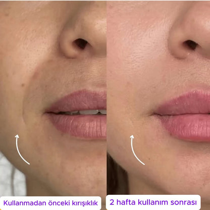 LenfMasaj Kontür Yüz Fırçası - Lenf Drenajı Masaj Fırçası (Kısa Süreliğine 1 Alana 1 Bedava!)